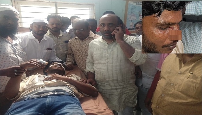 మున్సిపల్ పోరు: టీఆర్ఎస్ అభ్యర్థి ముక్కు కొరికిన కాంగ్రెస్ అభ్యర్థి మున్సిపల్ పోరు: టీఆర్ఎస్ అభ్యర్థి ముక్కు కొరికిన కాంగ్రెస్ అభ్యర్థి