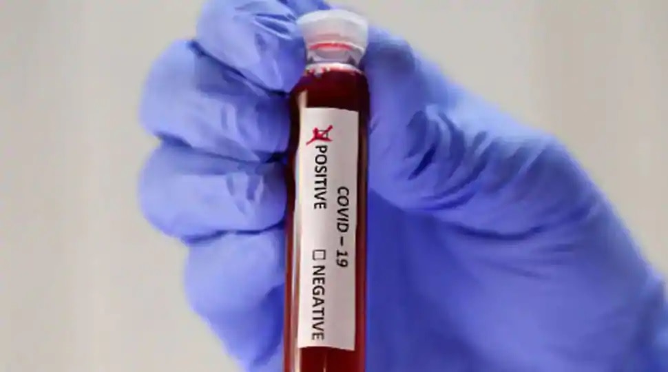 COVID19 Symptoms: కరోనా పేషెంట్లలో ముఖ్యమైన లక్షణాలివే COVID19 Symptoms: కరోనా పేషెంట్లలో ముఖ్యమైన లక్షణాలివే