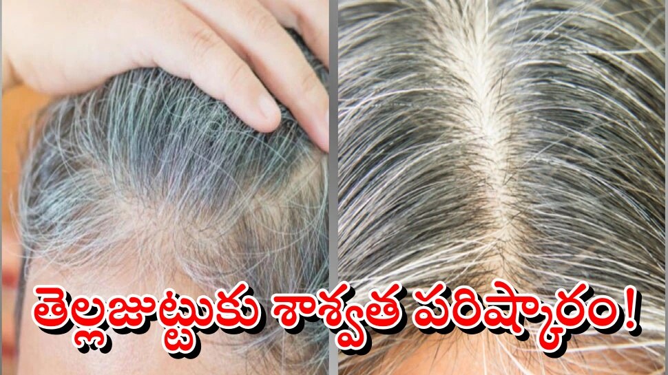 White Hair Solution: తెల్లజుట్టు శాశ్వతంగా నల్లగా మారాలంటే ఇలా చేయండి!