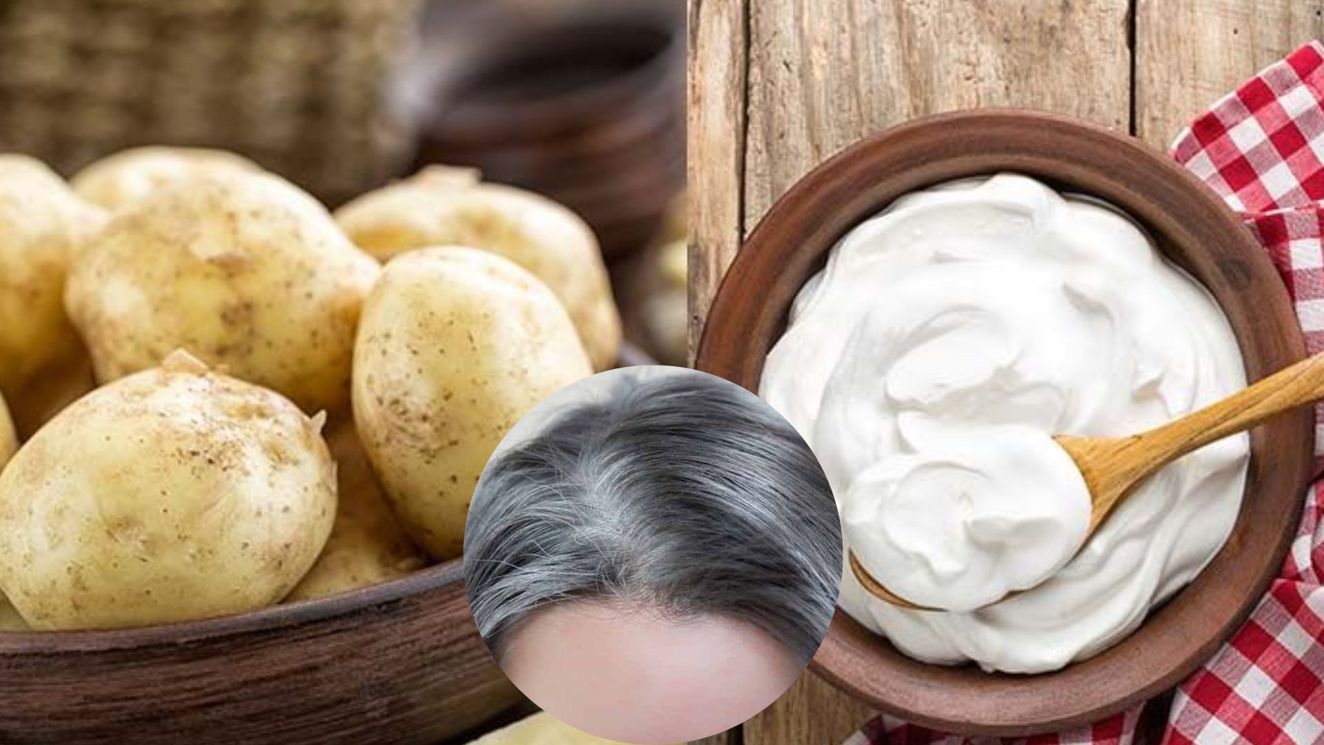 White Hair Problem Mixture Of Potato Juice And Curd Can Relieve White