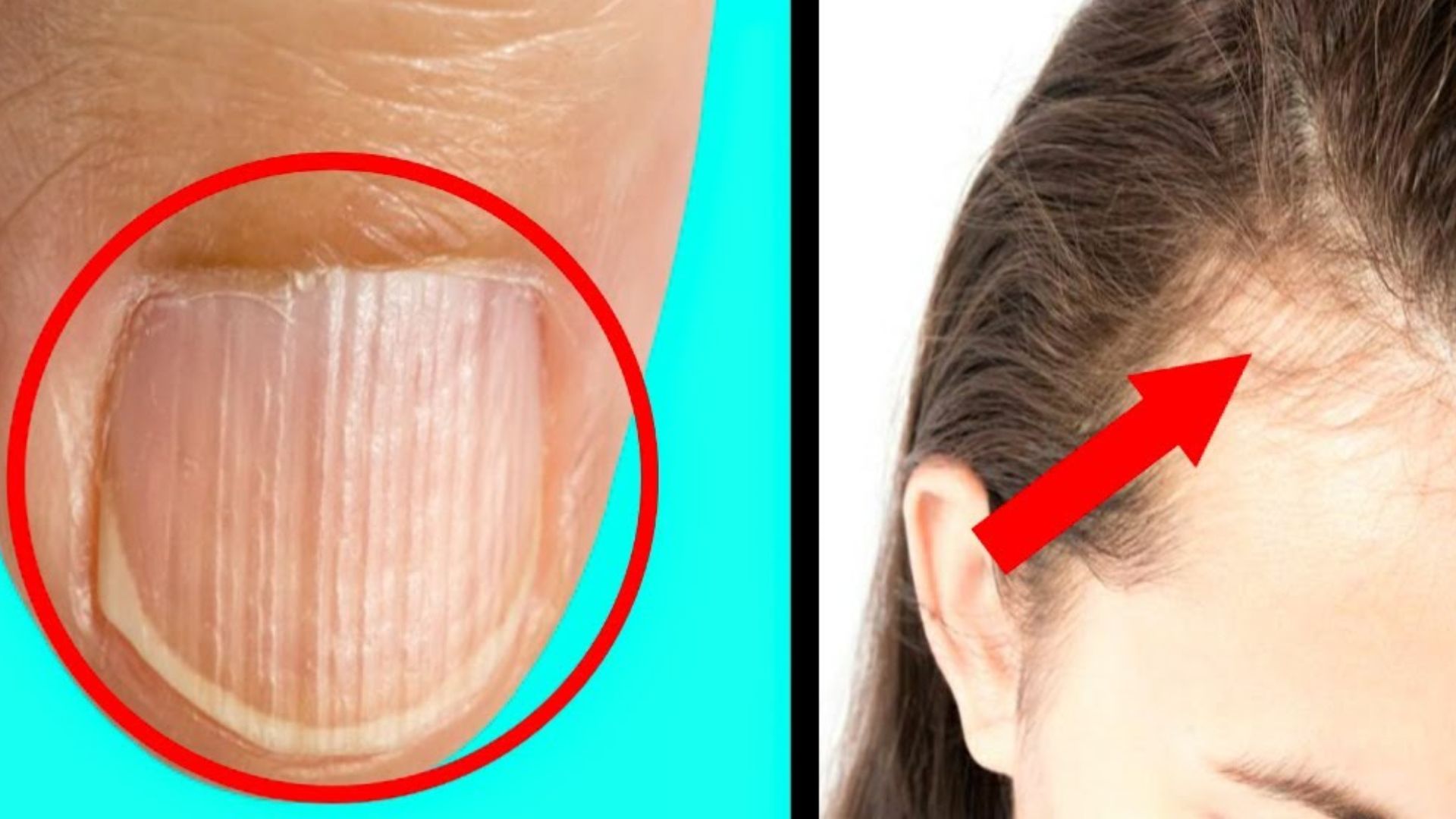 Zinc Deficiency in the Body Frequent Hair Loss Is Like Laving Zinc