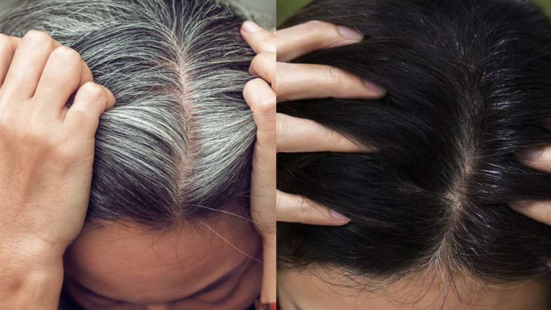 White Hair Treatment At Home If You Are Suffering From White Hair