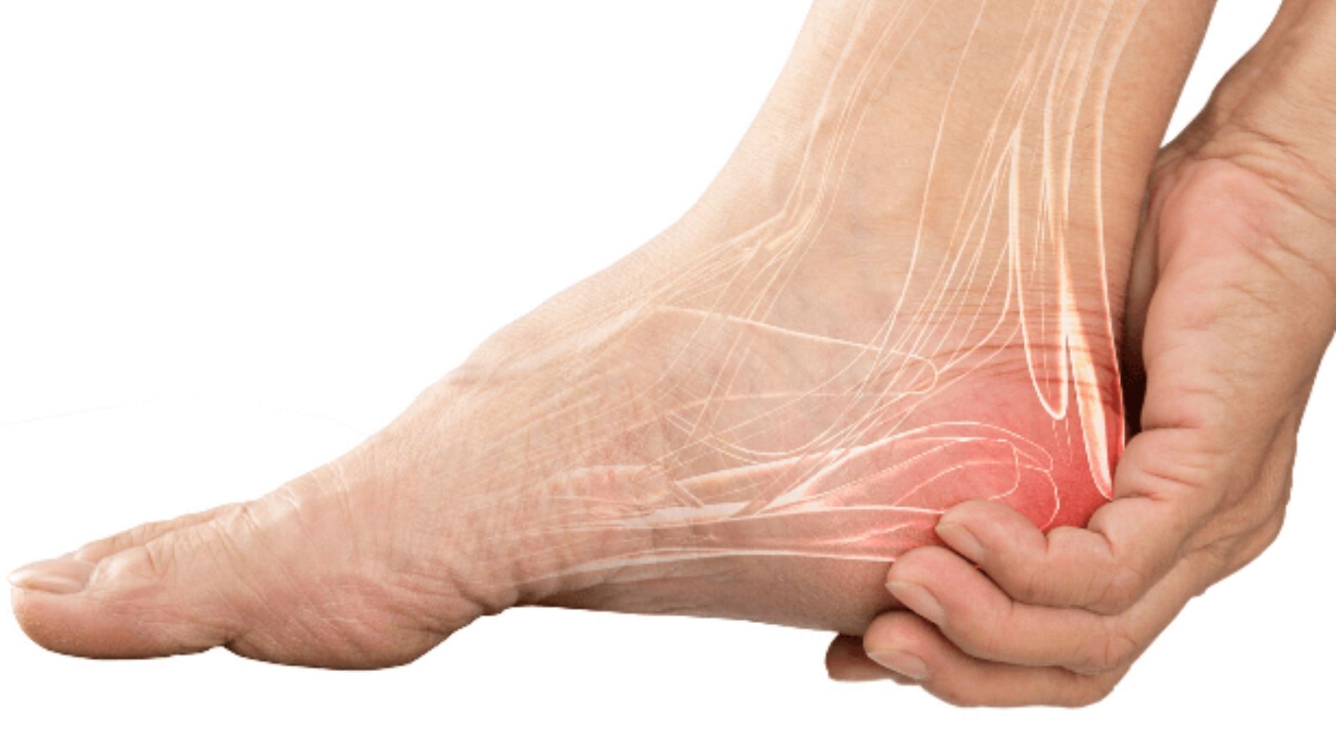 Heel Pain Relief Use Jilledu Leaves To Get Relief From Heel Pain