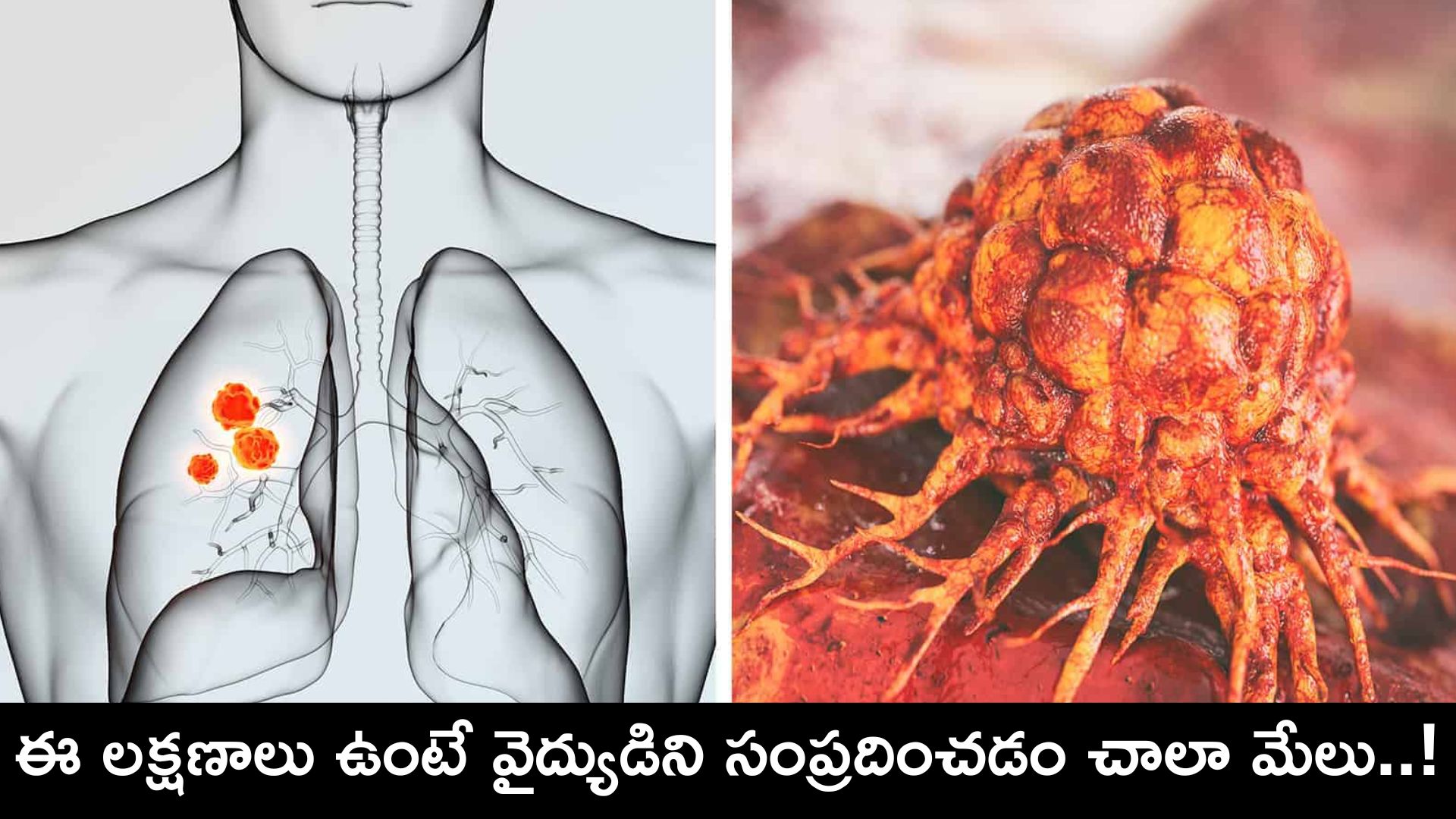 cancer-symptoms-in-telugu-vaginal-bleeding-depression-blood-in-stool