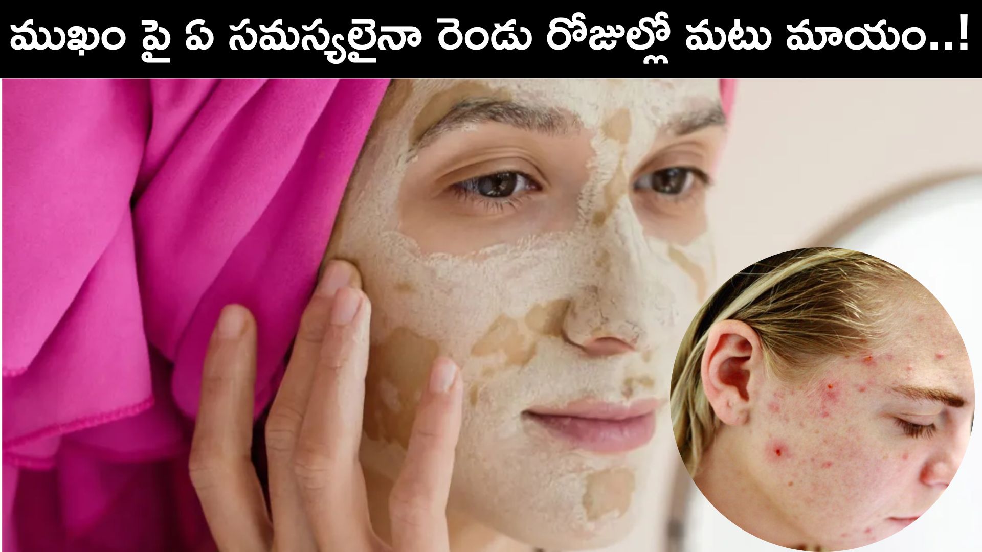 Face Beauty Tips In Telugu Get Rid Of