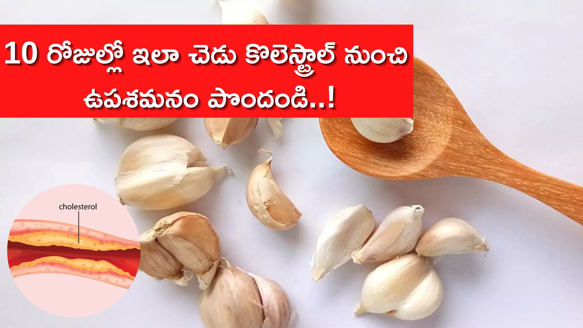 Cholesterol Control In 5 Days Get Relief From Bad Cholesterol In 10 Days With Garlic Cloves