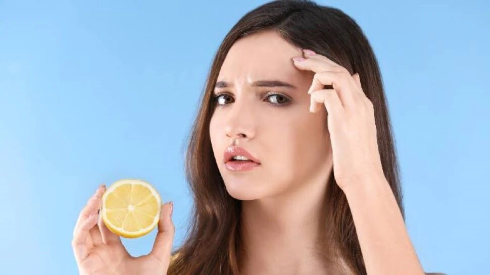 Is Applying Lemon On Face Good For Acne