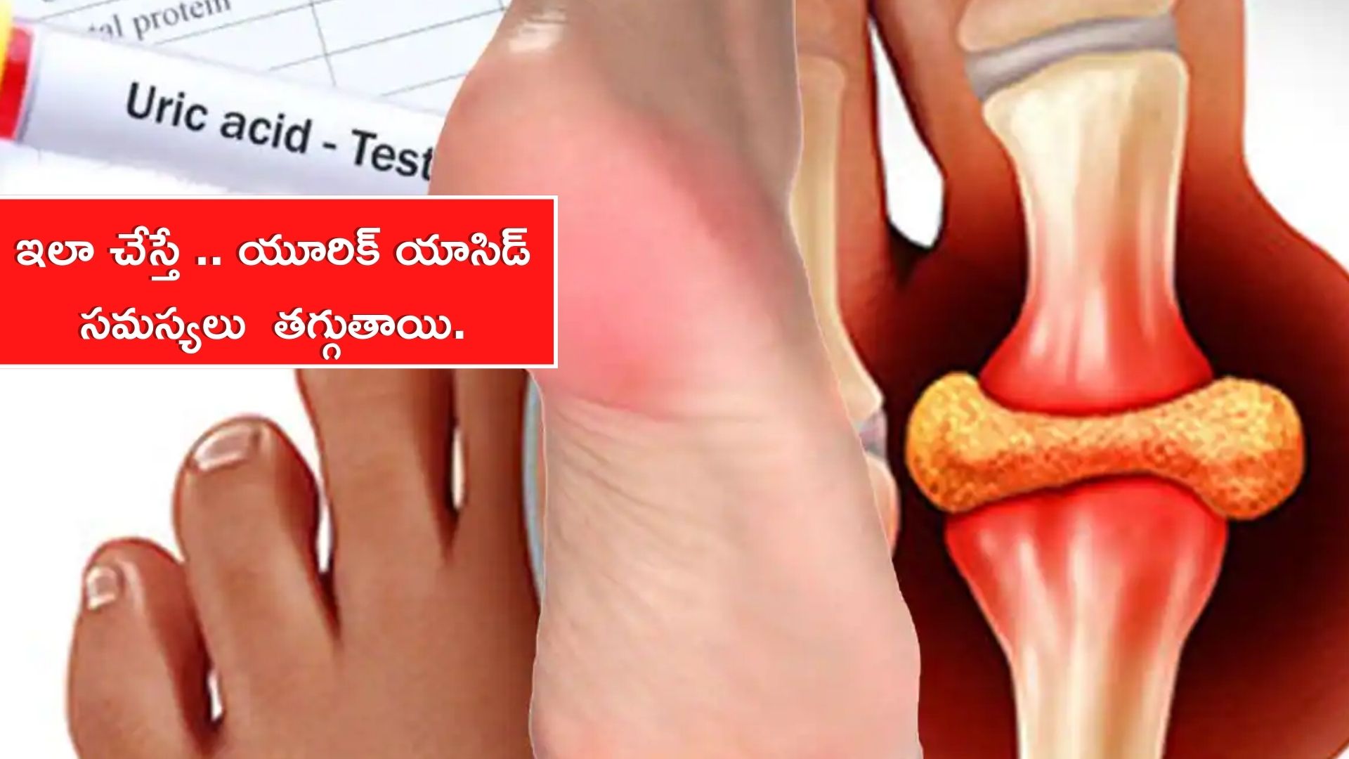 Control High Uric Acid: యూరిక్ యాసిడ్ సమస్యతో బాధపడుతున్నారా.. ఇలాంటి ఆహారాలను తీసుకుంటే 5 రోజుల్లో  తగ్గుతాయి. 