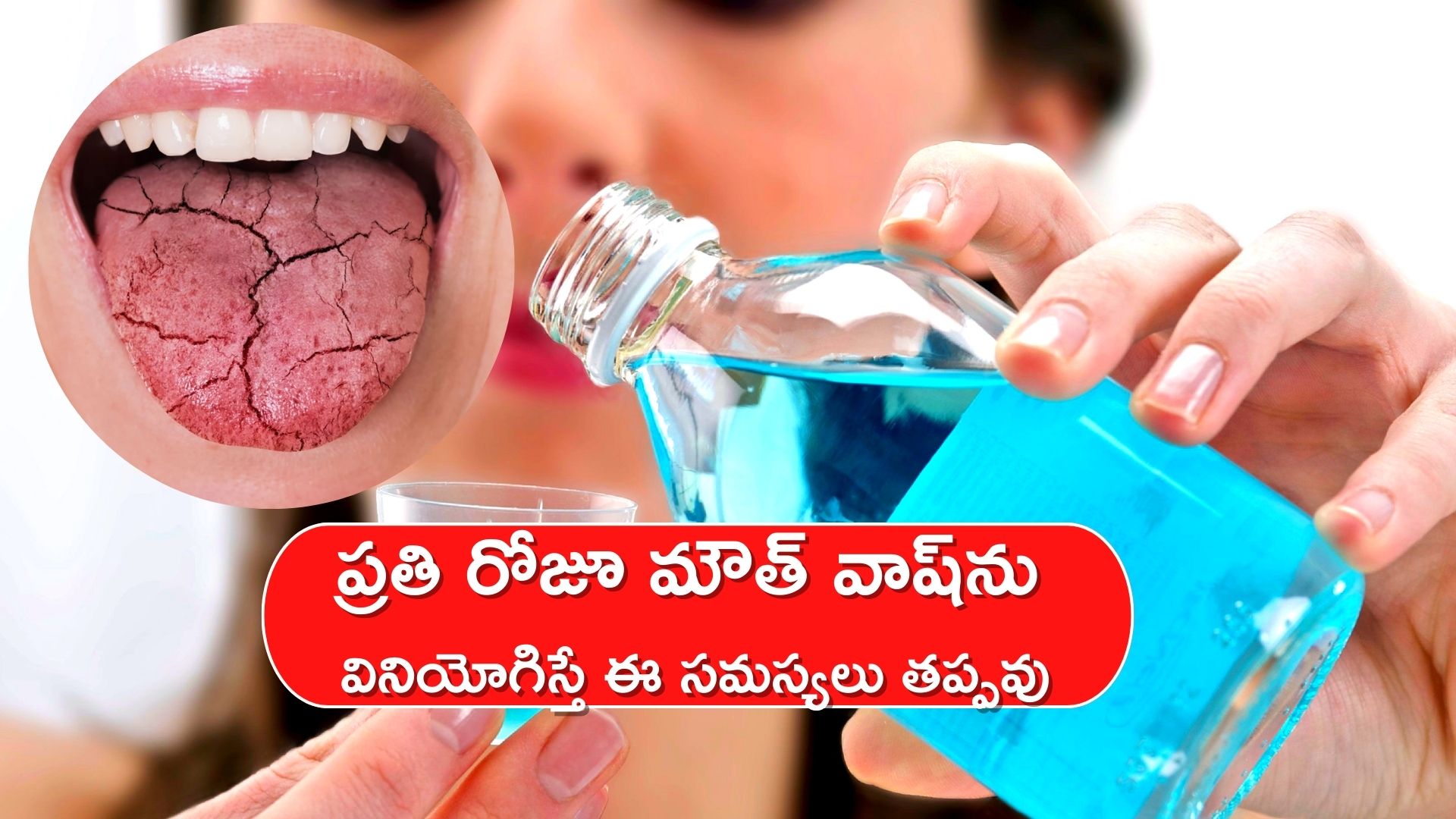 Dental Mouthwash Side Effects Daily Use Of Mouthwash Can Lead To Dry