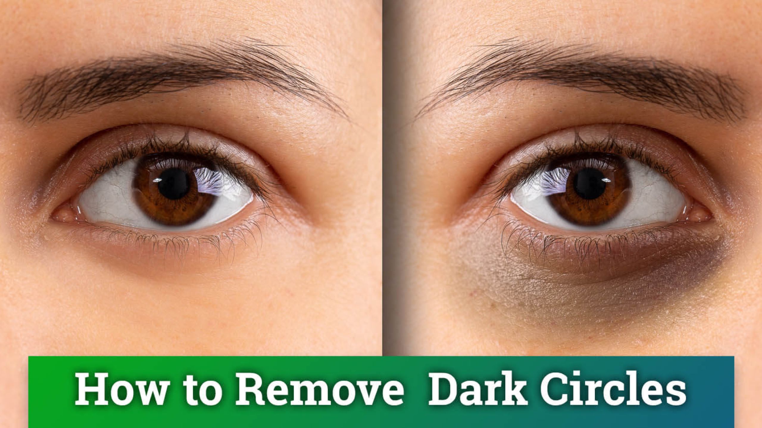 Dark Circles Can Rid With Potato, Lemon, Tomato mixed Juice In Just 4