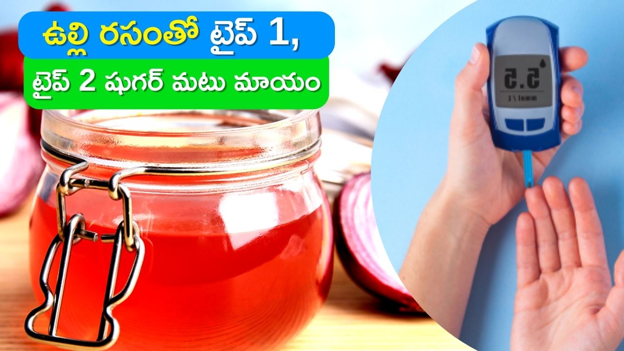 Onion Juice Diabetes Drinking Onion Juice Every Day Reduces Type 1 And
