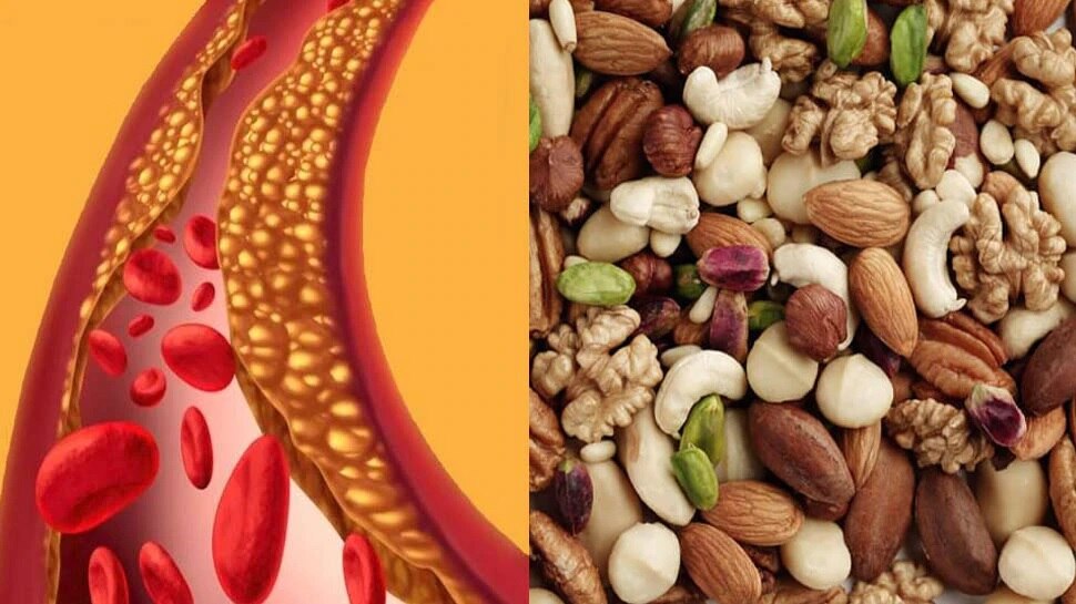 is cashews increase cholesterol, here is the fact జీడిపప్పు తింటే