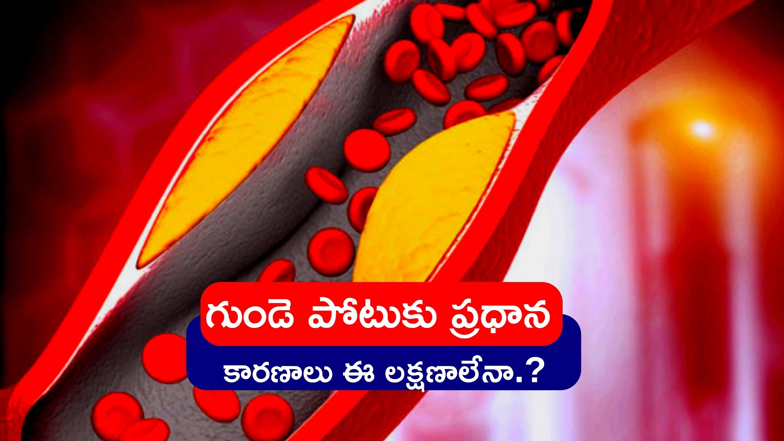 High Cholesterol: ఈ చిన్న వ్యాధులే రేపటి గుండె పోటుకు దారి తీస్తున్నాయి..!