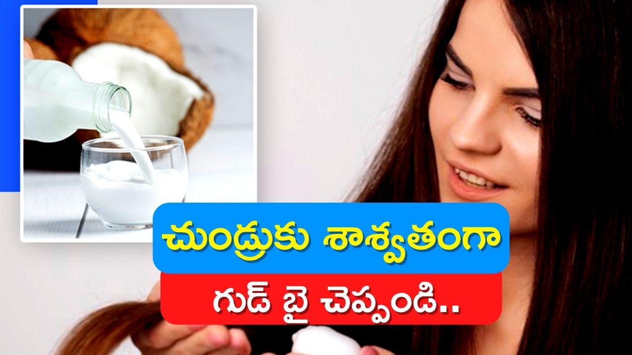 Coconut Milk: ఈ పాలతో ఎలాంటి ఖర్చు లేకుండా చుండ్రుకు శాశ్వతంగా గుడ్‌ బై చెప్పండి..