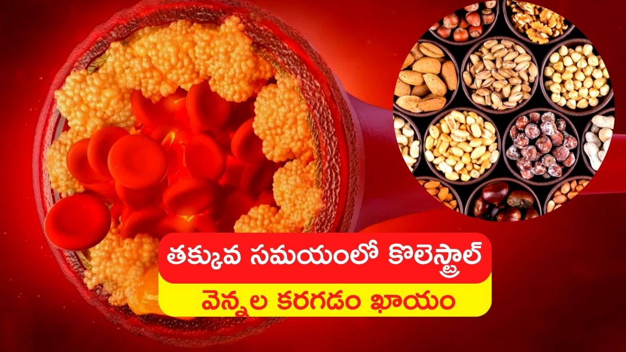 Reducing Bad Cholesterol Eating Pistachios Almonds Walnuts And Peanuts