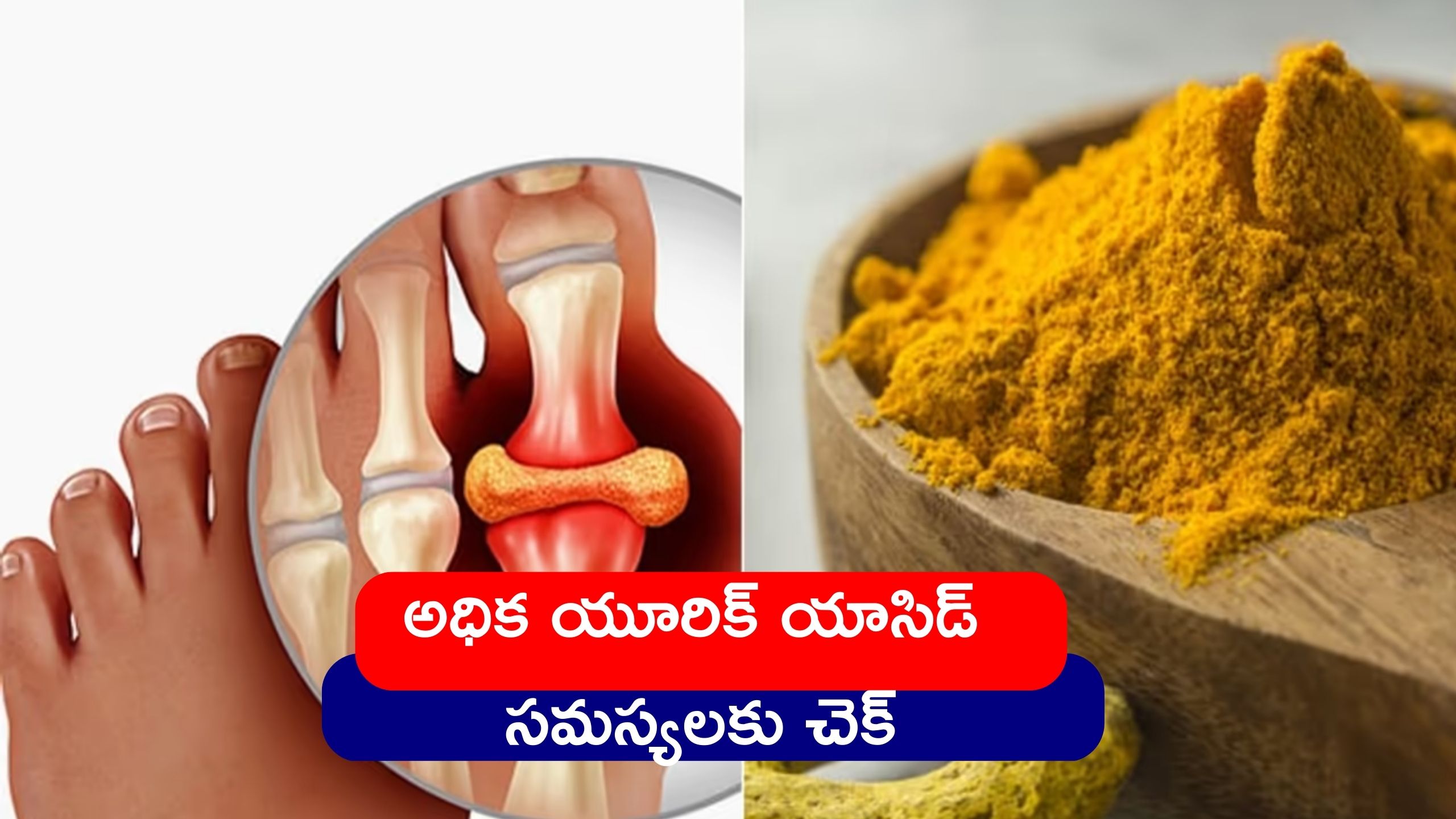  High Uric Acid: అధిక యూరిక్ యాసిడ్ సమస్యలకు చెక్‌..ఇప్పుడే ఈ పాలు తాగండి..