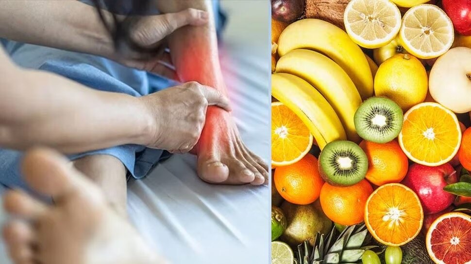 these-fruits-control-uric-acid-and-reduce-the-joint-pains-uric-acid