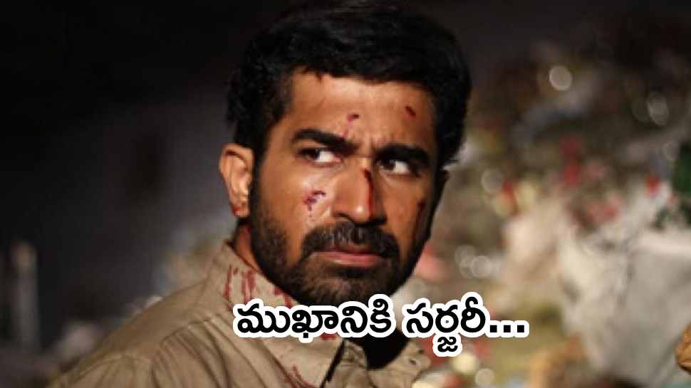 Vijay Antony Critical Stage: తీవ్ర విషమంగా విజయ్ అంటోనీ ఆరోగ్యం.. డాక్టర్లు ఏమంటున్నారంటే?