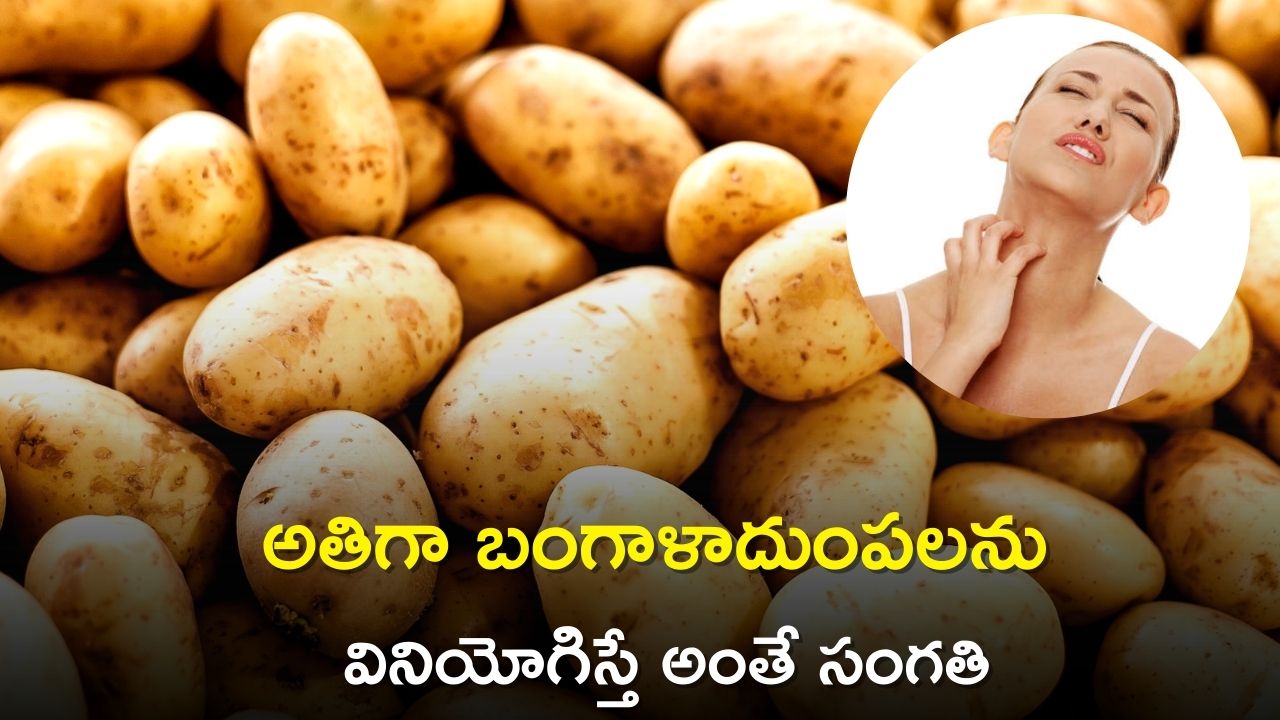 Potato Side Effect Eating Too Much Potatoes Can Cause Allergy Gout