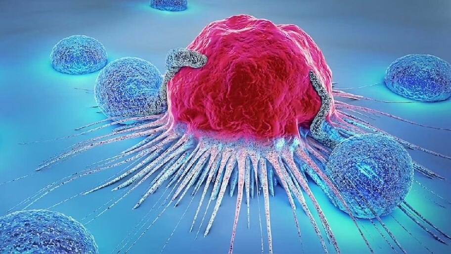 Cancer prevention tips, causes and symptoms, how many types of cancer ...