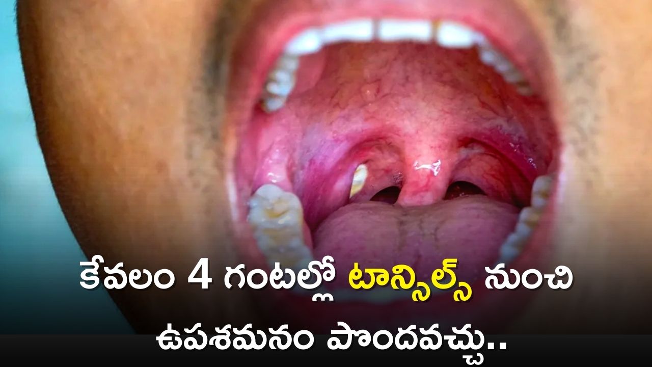 If You Drink Green Tea And Barley Water Can Reduce Tonsils In 4 Hours