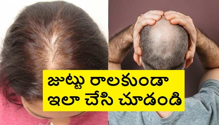 Hair Loss Issue: జుట్టు రాలుతోందని టెన్షన్ పడుతున్నారా ?