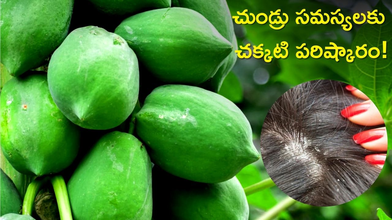 Dandruff Removal: చుండ్రు సమస్యలకు చక్కటి పరిష్కారం, ఈ చిట్కాతో చెక్‌!