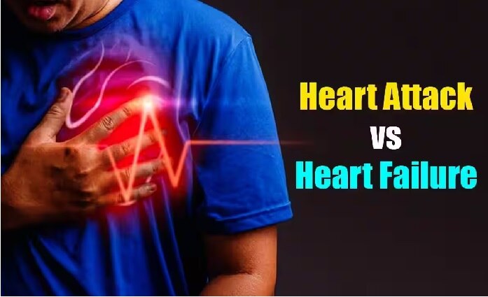 Heart Attack vs Heart Failure: గుండెపోటుకు గుండె విఫలానికి మధ్య తేడాలు, లక్షణాలు, కారణాలేంటి