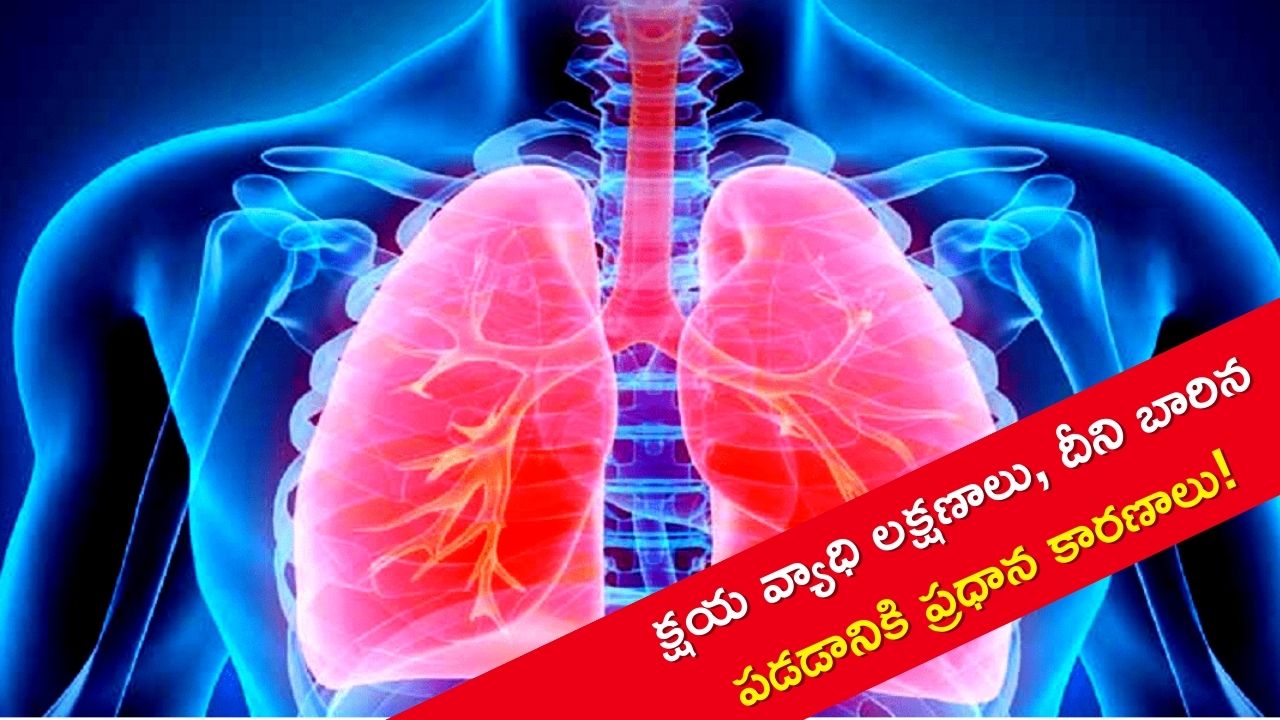 World Tb Day 2023: క్షయ వ్యాధి లక్షణాలు, ఎందుకు కోట్ల మంది ఈ సమస్య బారిన పడుతున్నారో తెలుసా?