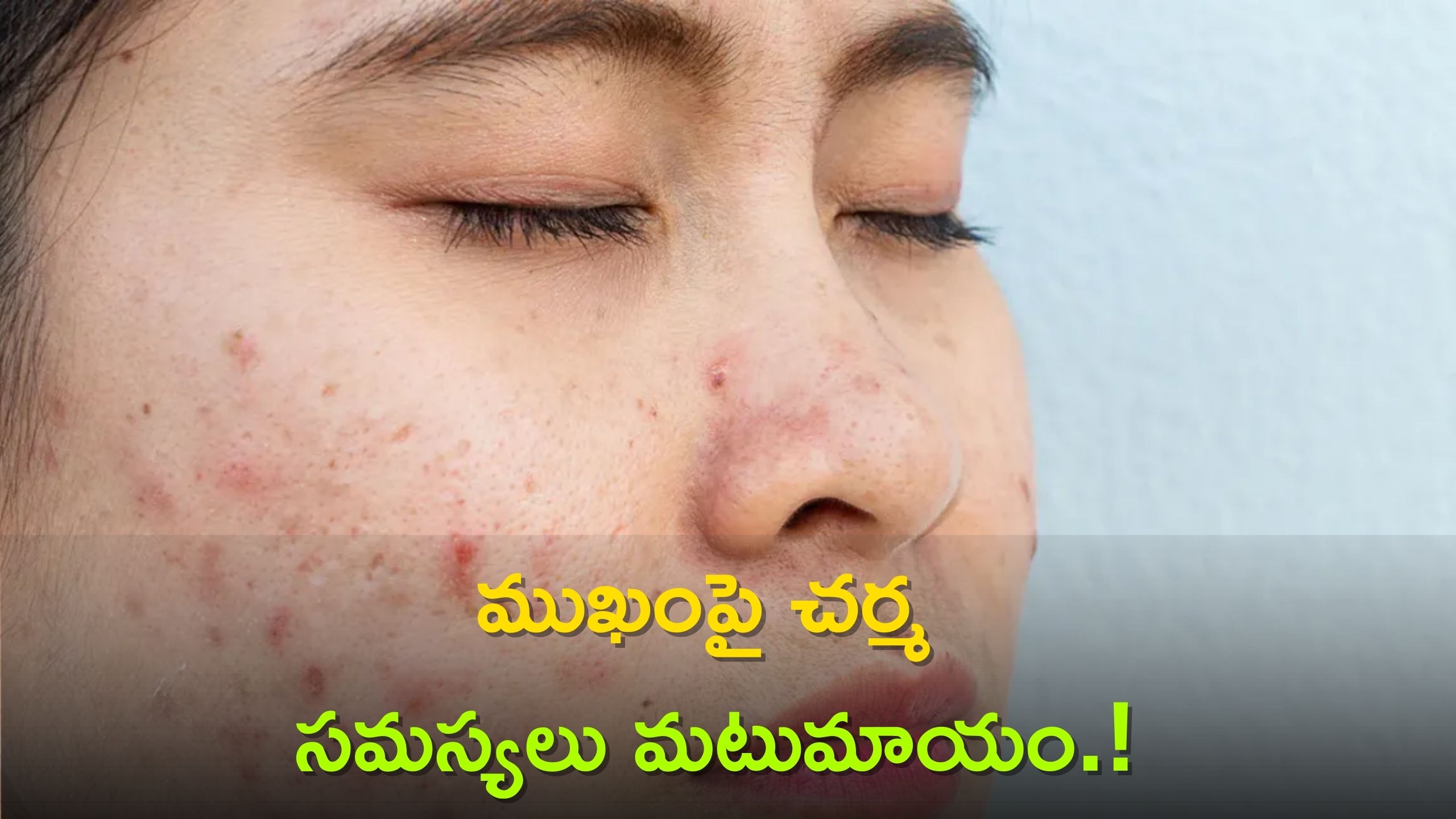 Natural Skin Care Tips At Home Milk Curd And Lemon Skin Problems On The Face Will Reduce In 3