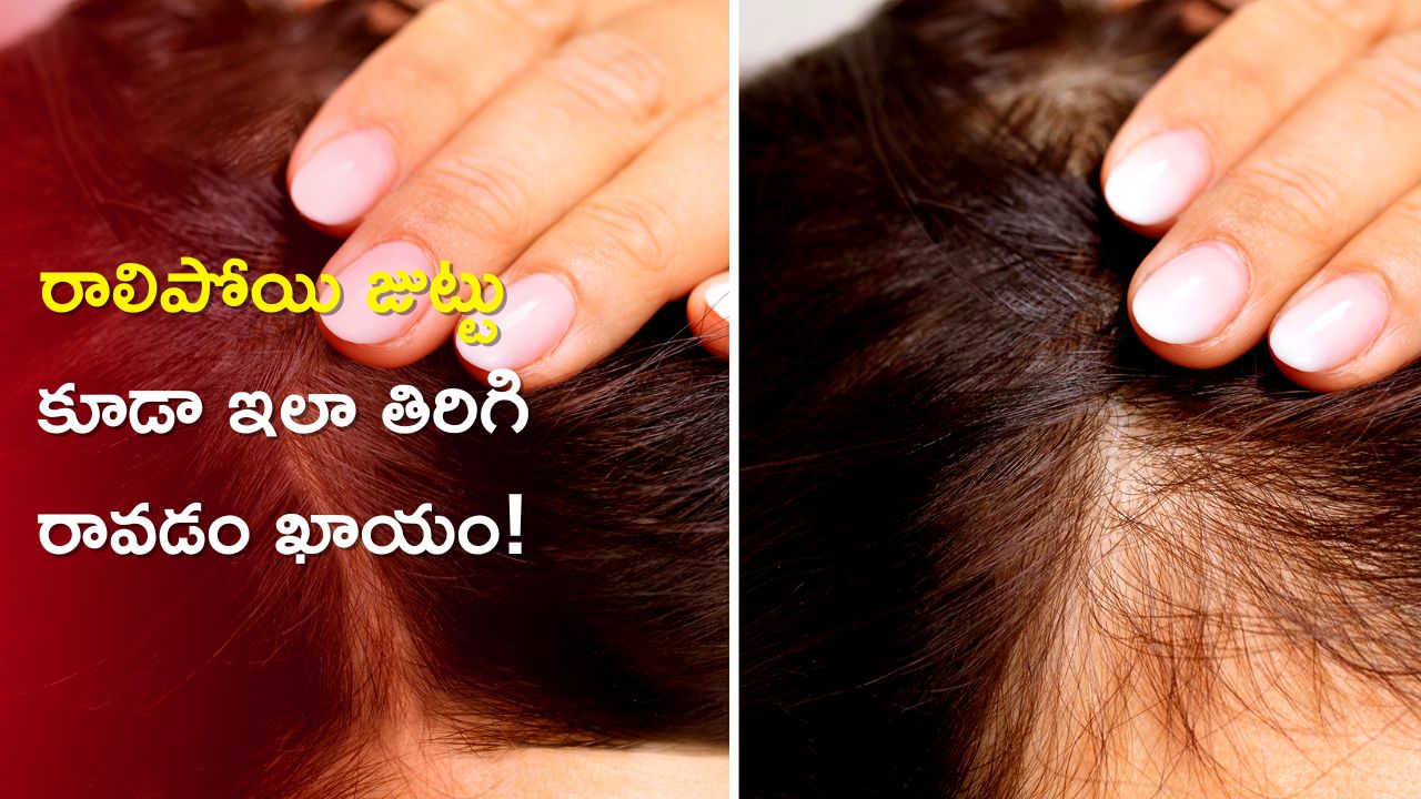 Reduce Hair Fall in 20 Days: ఈ ఫుడ్ తో రాలిపోయిన జుట్టు 20 రోజుల్లో తిరిగి రావడం ఖాయం!