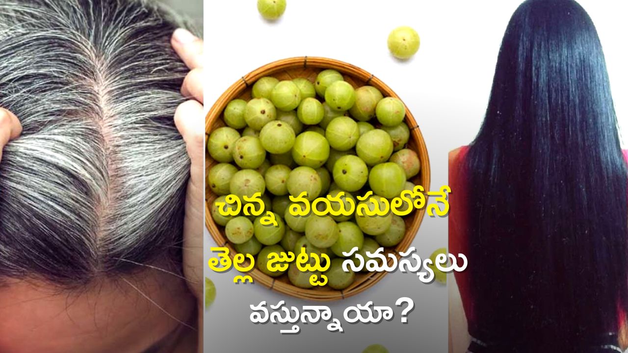 White Hair Problem: తెల్ల జుట్టు వస్తుందా? ఇలా చేస్తే శాశ్వతంగా 7 రోజుల్లో మాయం!