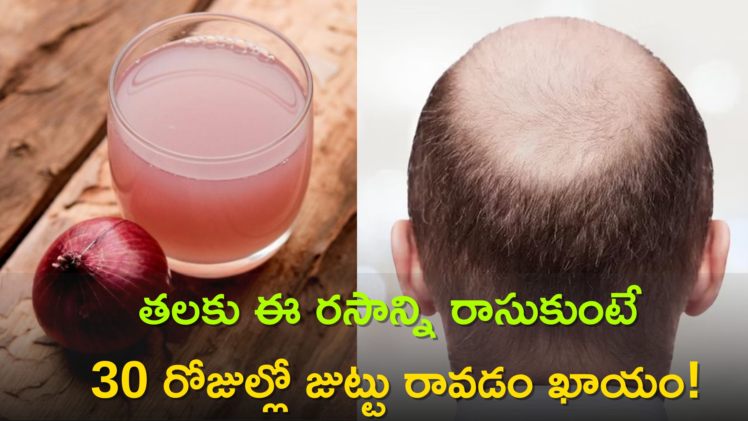 Onion Juice Can Hair Grow On Bald Head In 30 Days ఉల్లిపాయ రసంలో