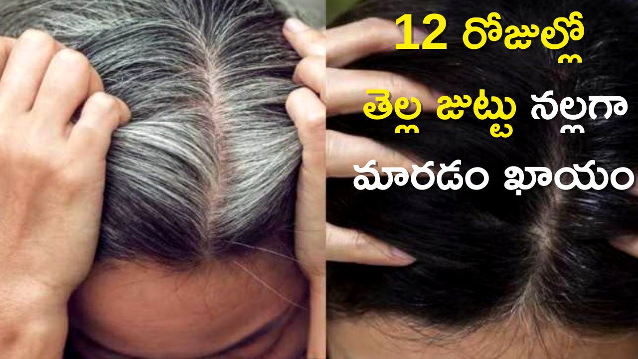  White Hair Problem: ఈ ఉసిరి మిశ్రమంతో 12 రోజుల్లో తెల్ల జుట్టు నల్లగా మారడం ఖాయం!