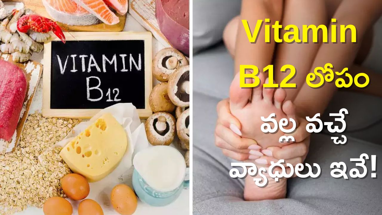 Vitamin B12 Deficiency Diseases Foods to Eat to Get Vitamin B12
