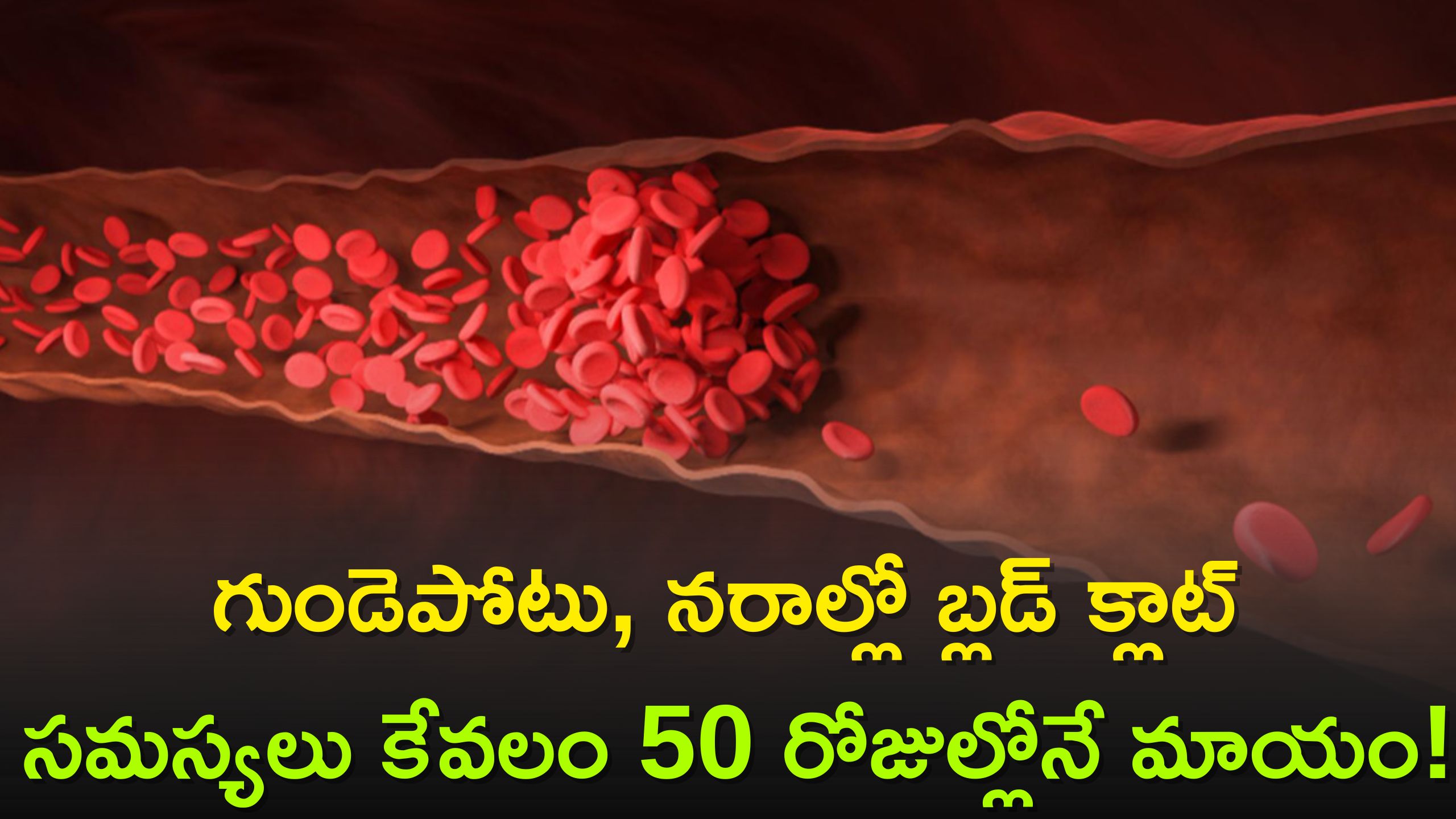 Blood Clots: వీటిని ప్రతిరోజు తీసుకుంటే.. గుండెపోటు, నరాల్లో బ్లడ్ క్లాట్ సమస్యలు కేవలం 50 రోజుల్లోనే మాయం!