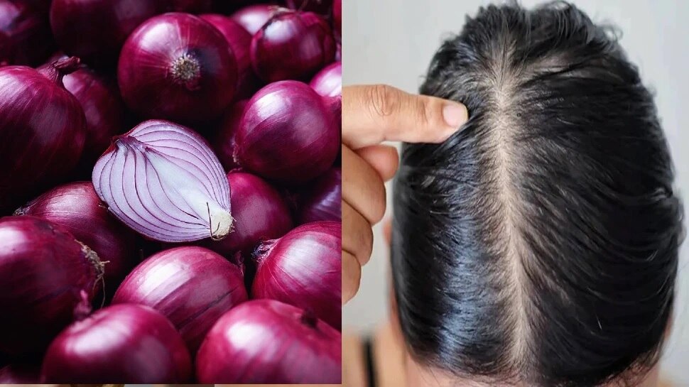 Hair care tips to remove dandruff problem forever use this home made