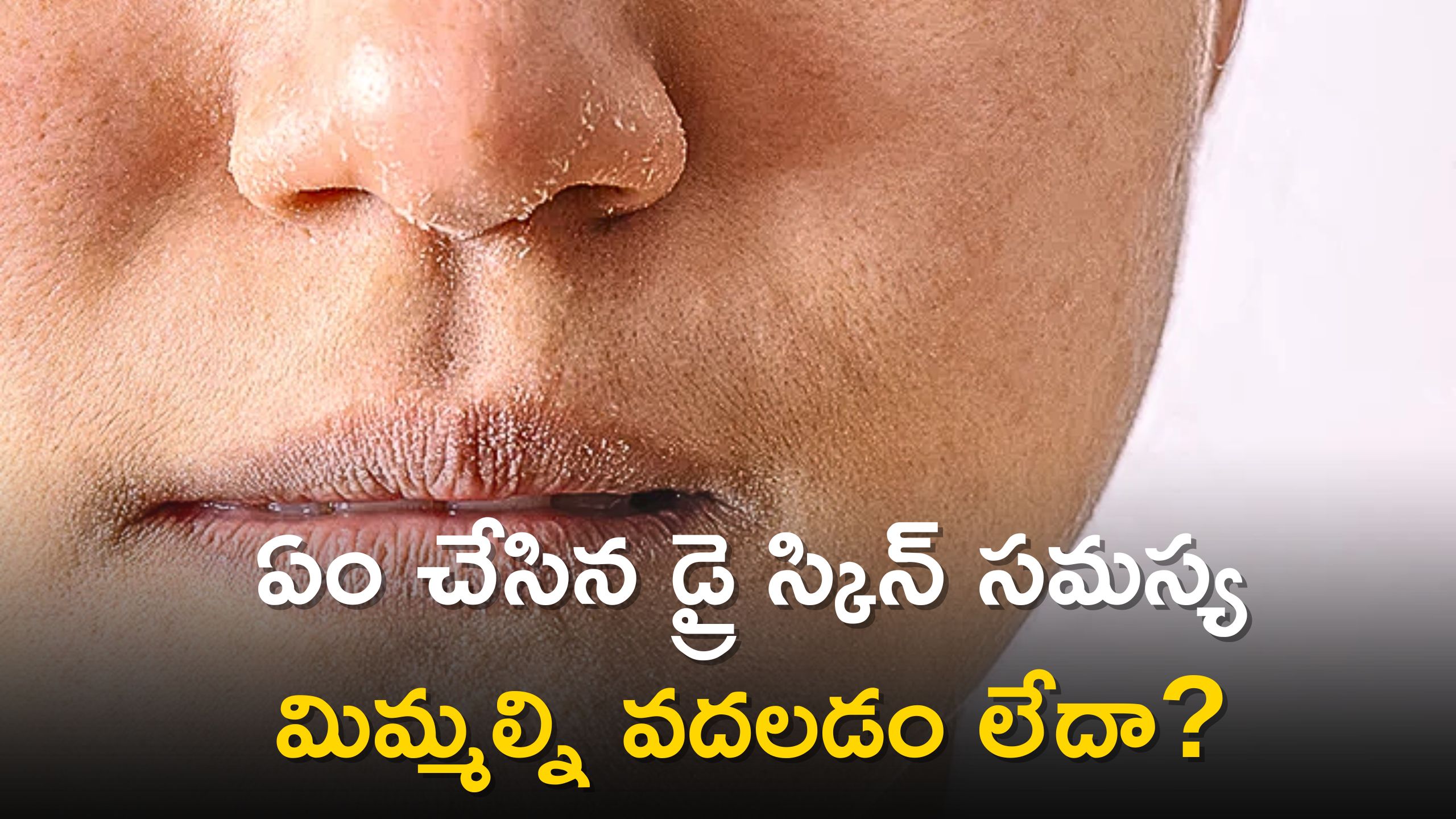 get-rid-of-dry-skin-on-nose