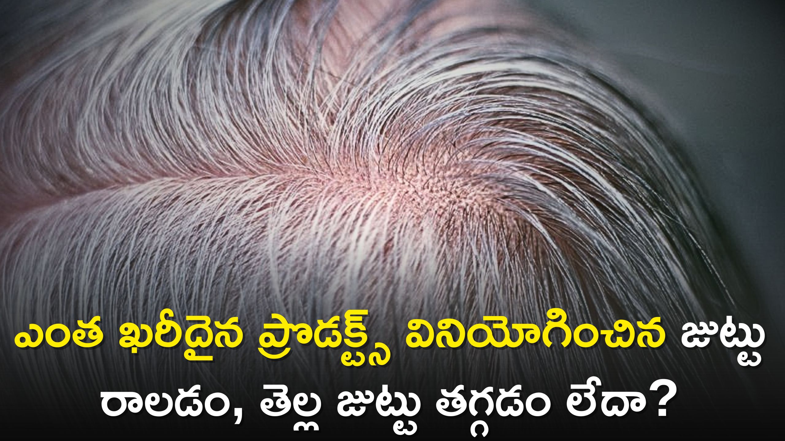 White Hair: ఎంత ఖరీదైన ప్రొడక్ట్స్ వినియోగించిన జుట్టు రాలడం, తెల్ల జుట్టు తగ్గడం లేదా? నయా పైసా ఖర్చు లేకుండా చెక్ పెట్టొచ్చు..