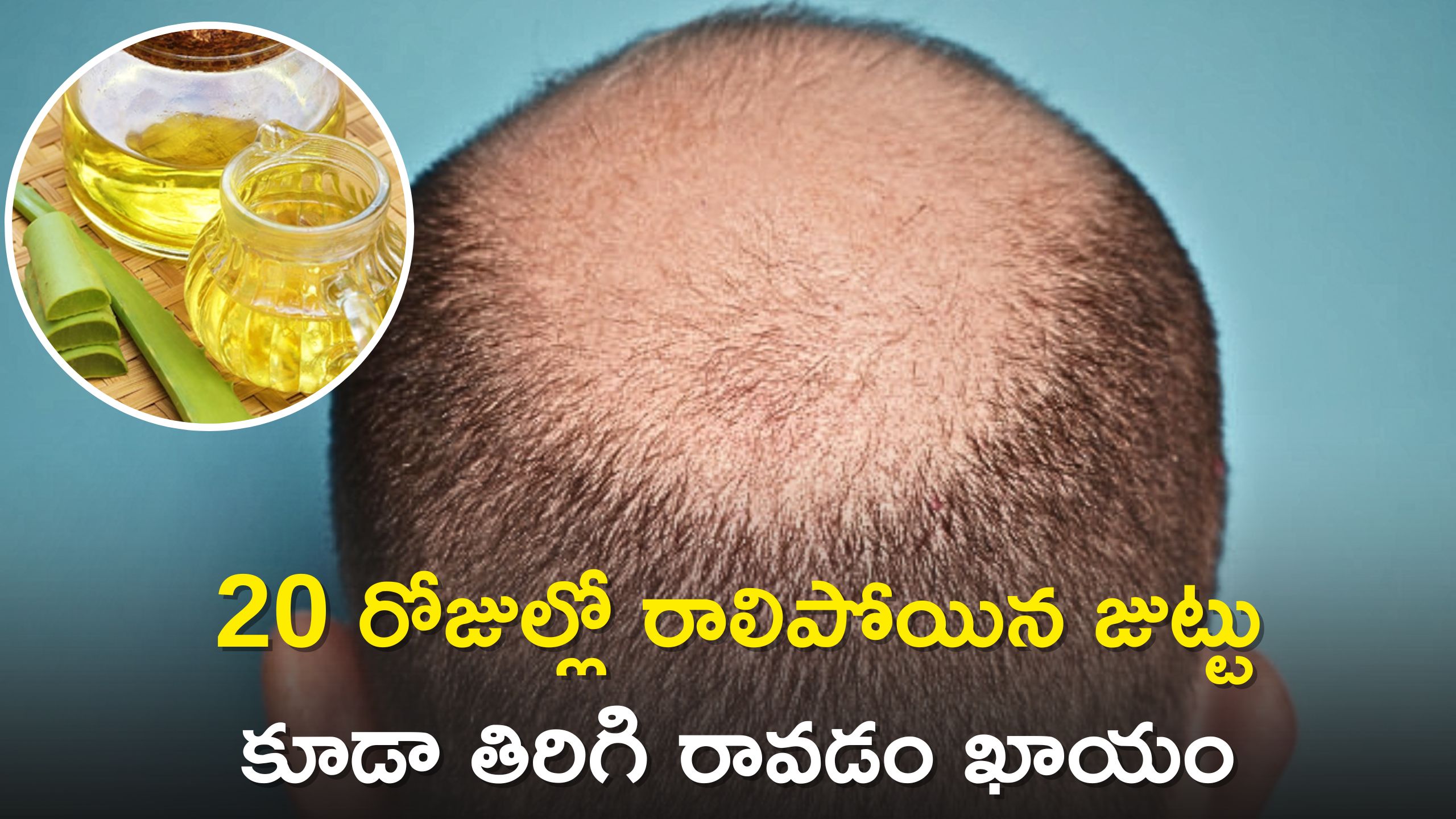 Anti Hair Fall Oil: ఈ నూనెతో 20 రోజుల్లో రాలిపోయిన జుట్టు కూడా తిరిగి రావడం ఖాయం..