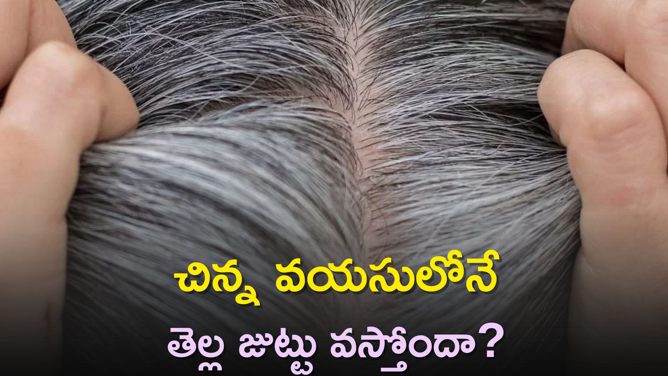 Premature White Hair: చిన్న వయసులోనే తెల్ల జుట్టు వస్తోందా? సోంపు నూనె ఒకటే పరిష్కారం