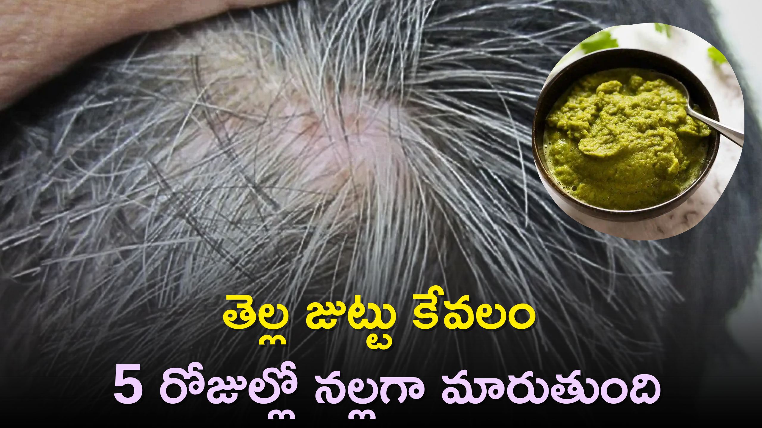 White Hair To Black Naturally: తెల్ల జుట్టుకు కర్రీలో వేసే ఈ ఆకులను వినియోగిస్తే 5 రోజుల్లో నల్లగా మారుతుంది..