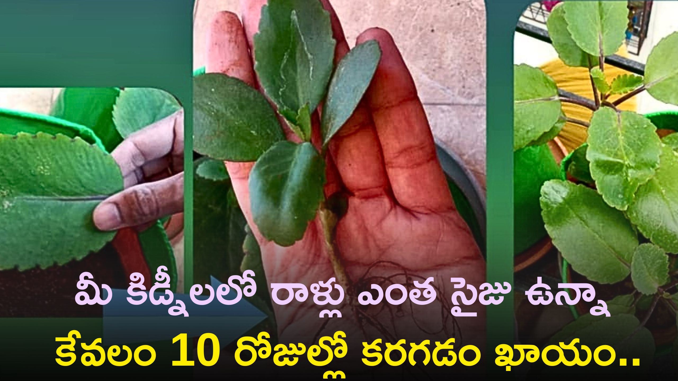 Ranapala Leaf Is Sure To Dissolve Kidney Stones Of Any Size In Just 10