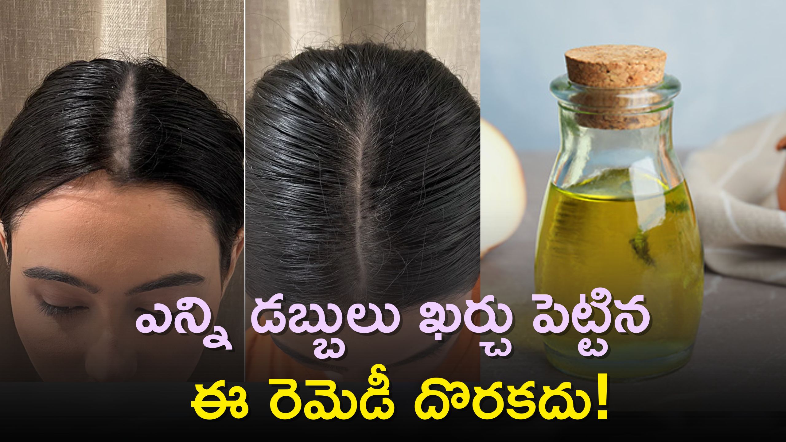 Best Oil For Hair Growth: ఒత్తైన, పొడవాటి జుట్టు రహస్యం..ఎన్ని డబ్బులు ఖర్చు పెట్టిన ఈ రెమెడీ దొరకదు!