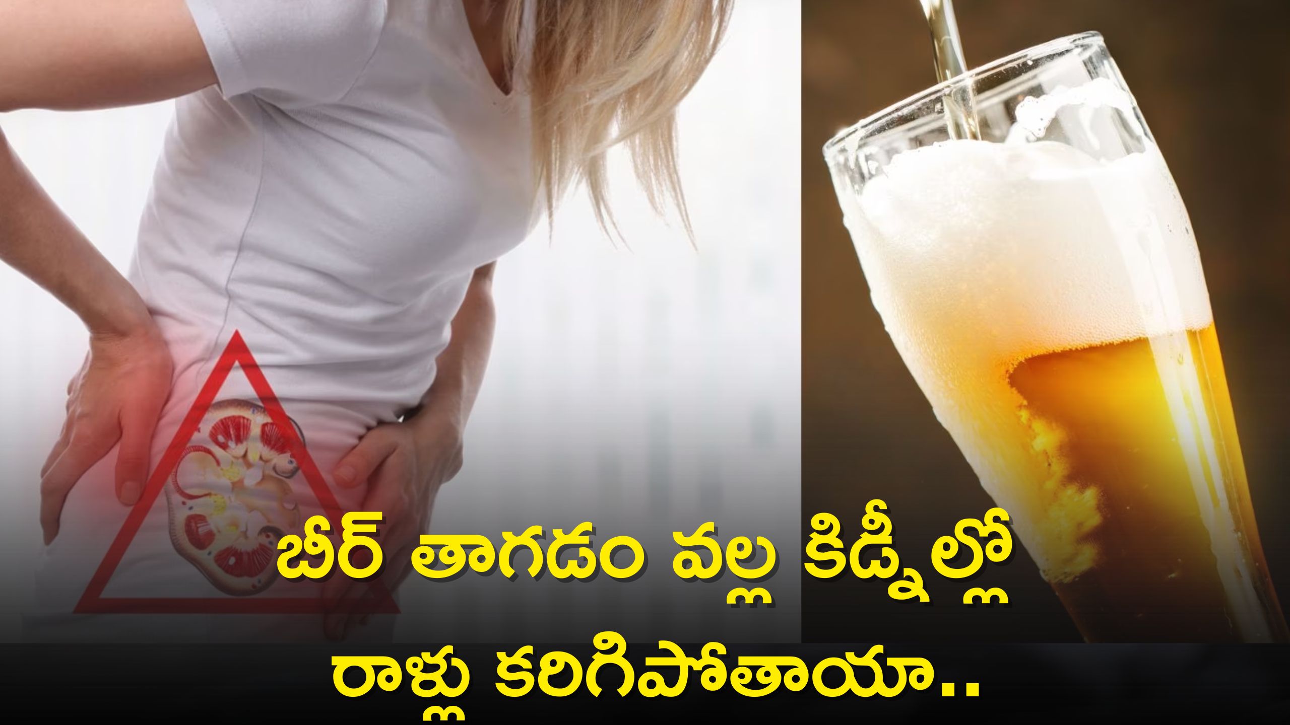 Drinking Beer Can Not Prevent Kidney Stones And Serious Health Problems