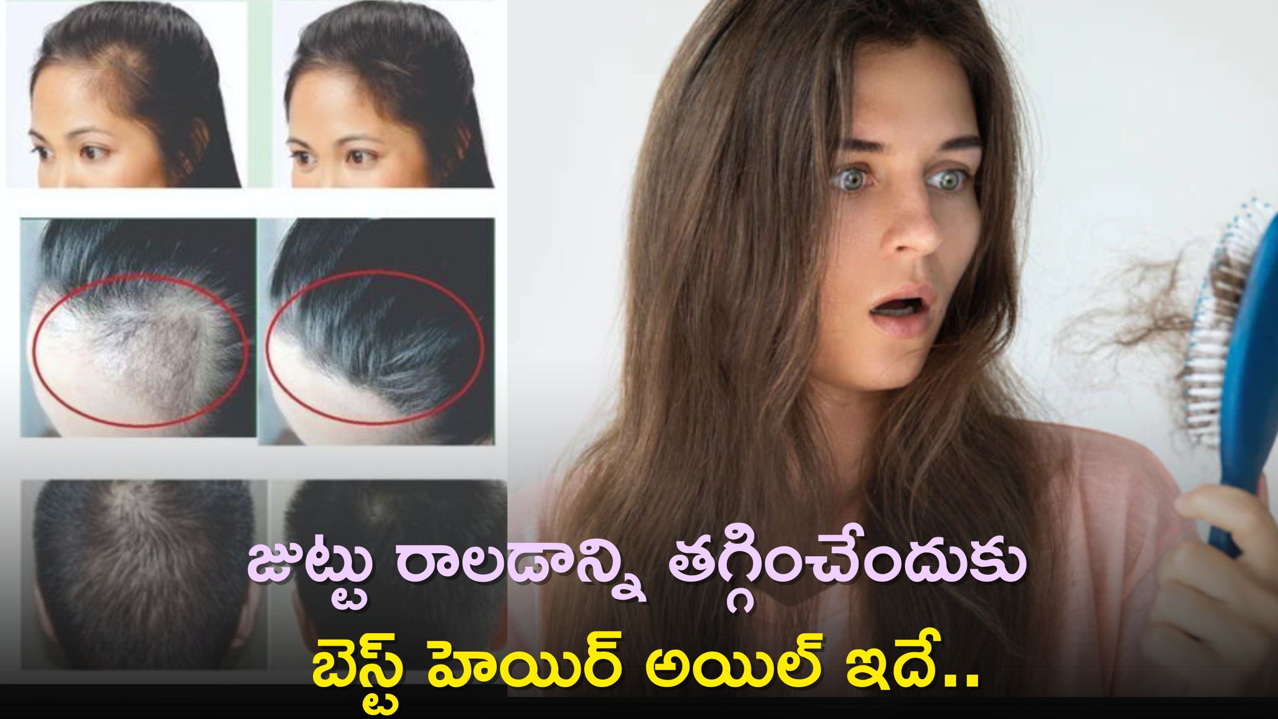 Hair Fall Control: జుట్టు రాలడాన్ని తగ్గించేందుకు బెస్ట్‌ హెయిర్‌ అయిల్‌ ఇదే..