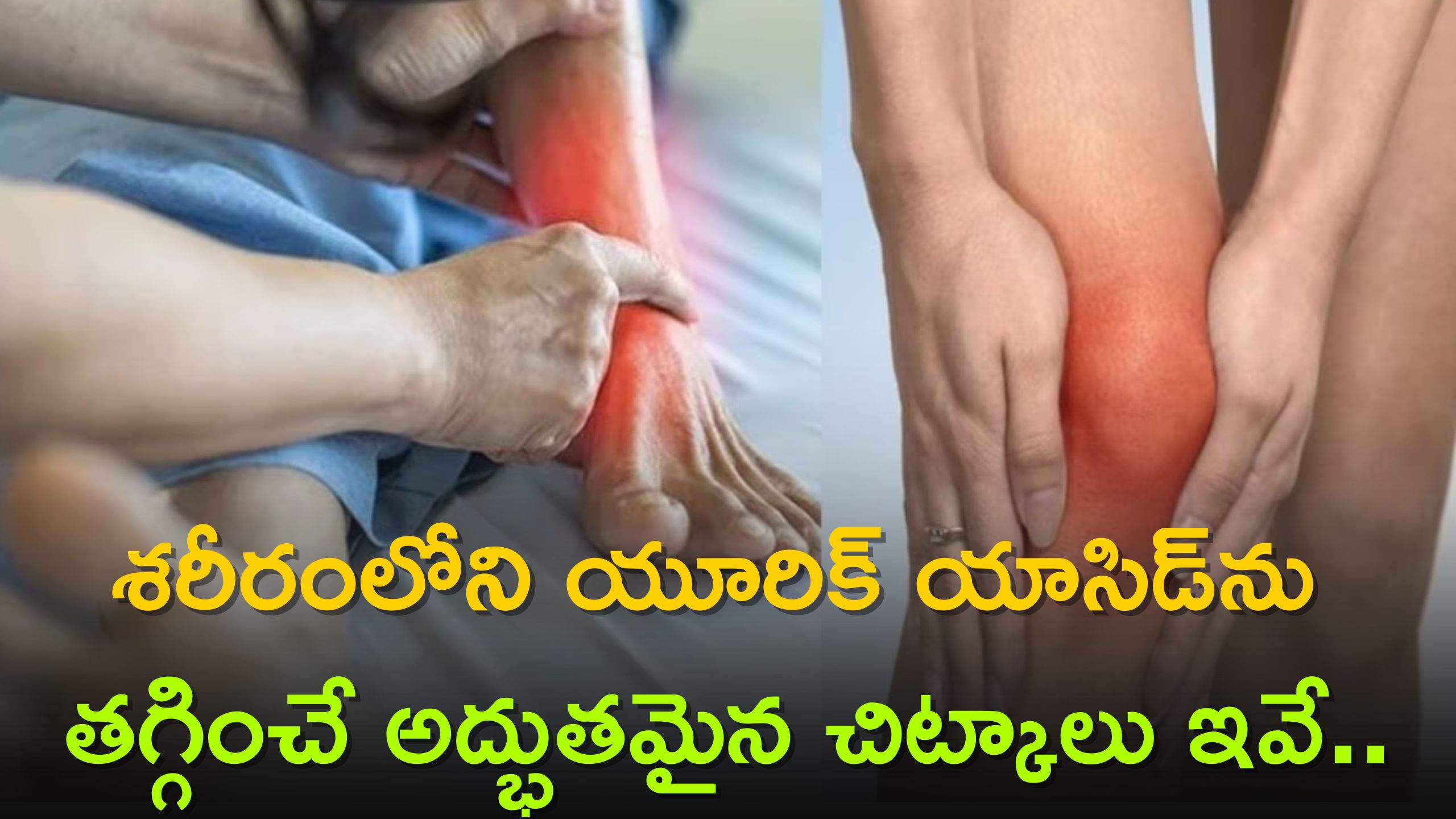  Uric Acid Control: శరీరంలోని యూరిక్ యాసిడ్‌ను తగ్గించే అద్భుతమైన చిట్కాలు ఇవే..