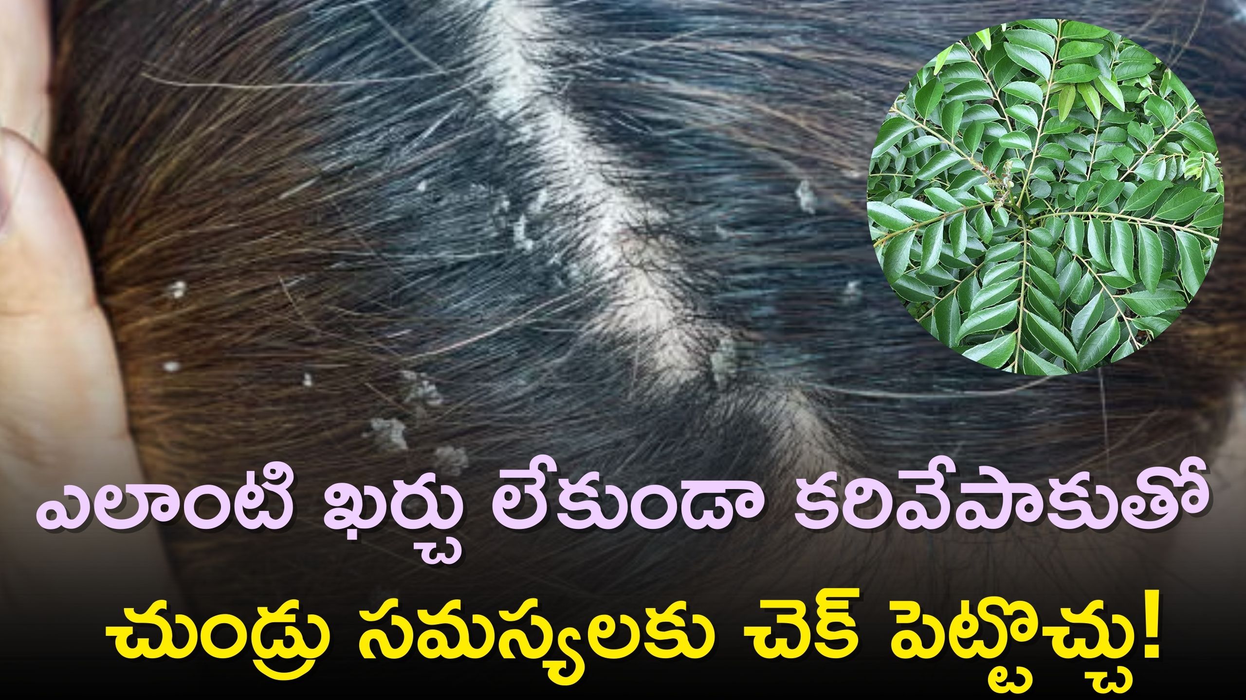 Dandruff: ఎలాంటి ఖర్చు లేకుండా కరివేపాకుతో చుండ్రు సమస్యలకు చెక్‌ పెట్టొచ్చు! 