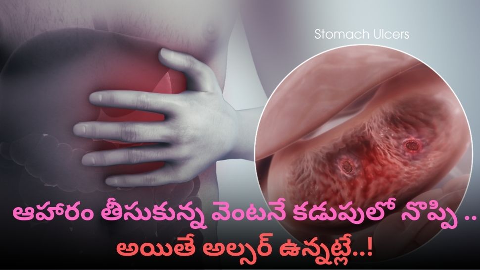 Ulcer: ఆహారం తీసుకున్న వెంట‌నే క‌డుపులో నొప్పి .. అయితే అల్స‌ర్ ఉన్న‌ట్లే..!