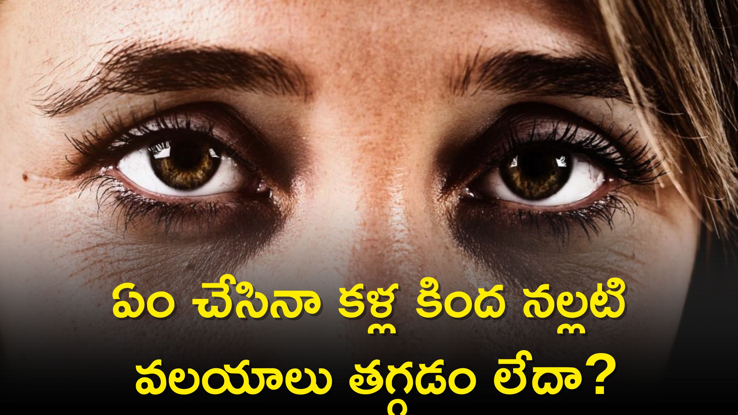 Dark Circles: ఏం చేసినా క‌ళ్ల కింద నల్లటి వలయాలు తగ్గడం లేదా? ప్రతిరోజు ఇలా చేయండి చాలు..